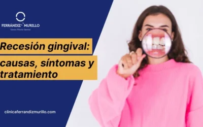 Recesión gingival: causas, síntomas y cómo se trata