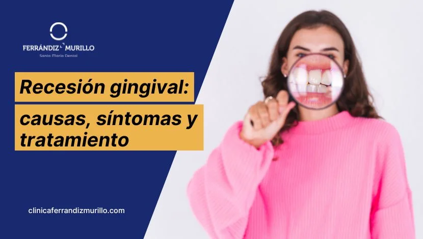 Recesión gingival