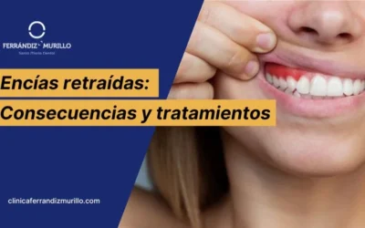 Encías retraídas: causas, consecuencias y tratamientos disponibles