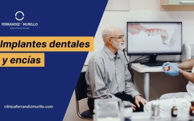 Implantes dentales y encías: qué condiciones necesitas para colocarte implantes con éxito