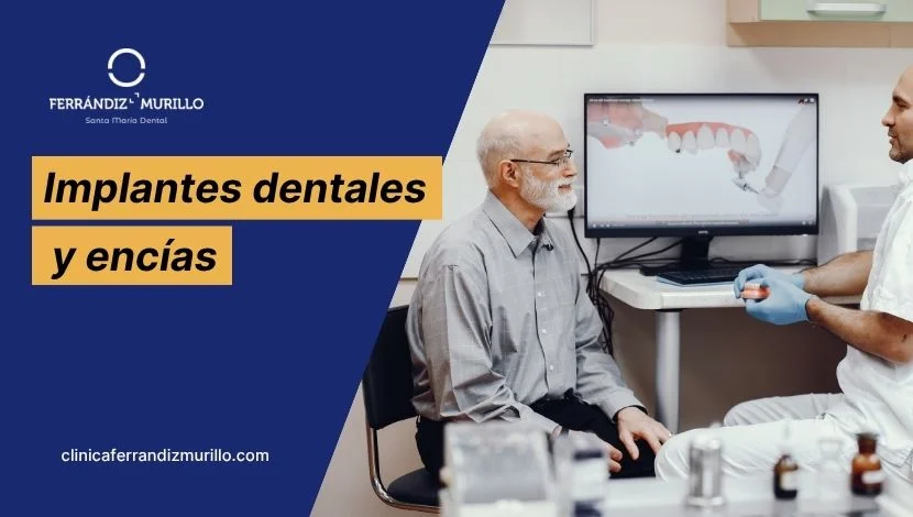 Implantes dentales y encías