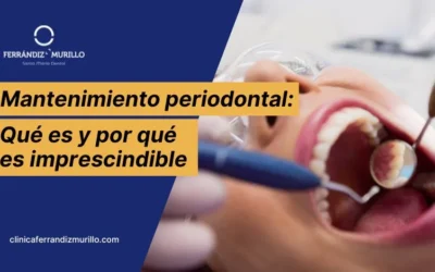 Mantenimiento periodontal: qué es y por qué es imprescindible después del tratamiento