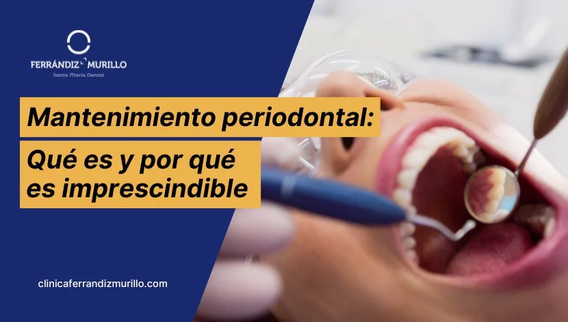 Mantenimiento periodontal