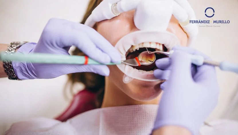 Mantenimiento periodontal tras tratamiento