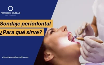 Sondaje periodontal: qué es y para qué sirve