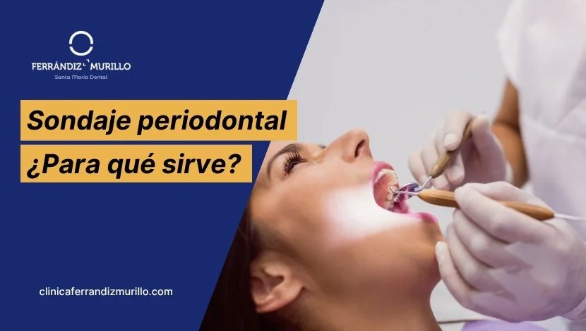 Sondaje periodontal