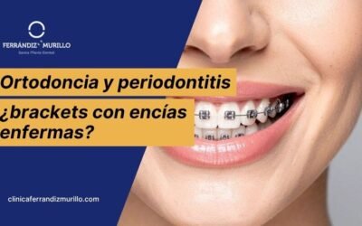 Ortodoncia y periodontitis: ¿se pueden poner brackets con las encías enfermas?