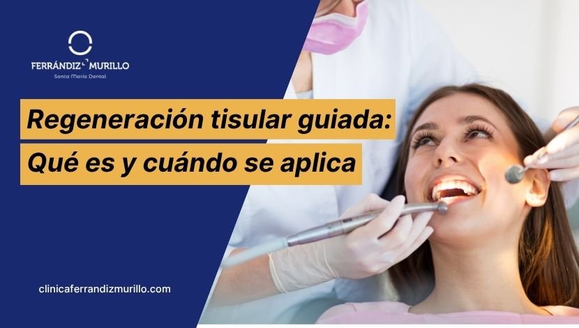 Tratamiento de regeneración tisular guiada Clínica Ferrándiz Murillo