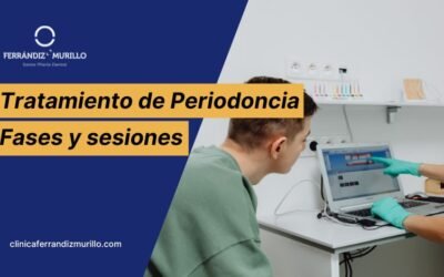 Cuánto dura un tratamiento de periodoncia: sesiones, fases y qué esperar en cada visita