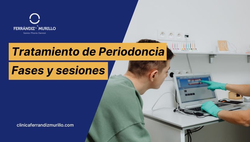 Tratamiento de periodoncia en clínica dental Ferrándiz Murillo El Puerto de Santa María