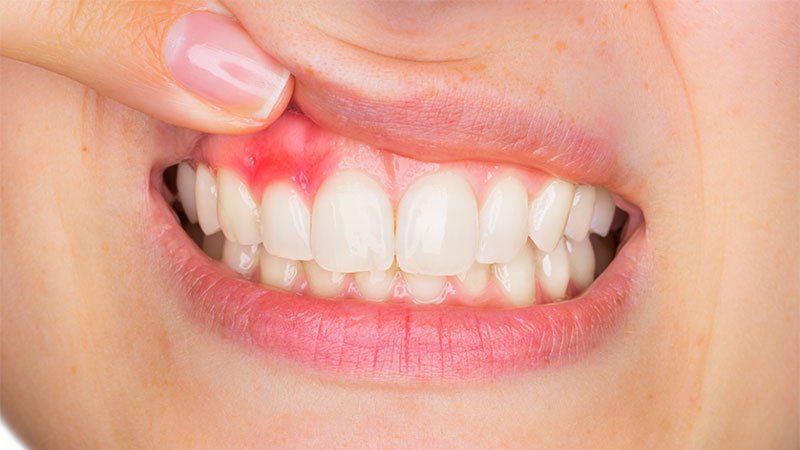 Periodoncista Puerto Real Clinica Dental Ferrandiz Murillo Periodoncia Puerto Real Clinica Dental Ferrandiz Murillo