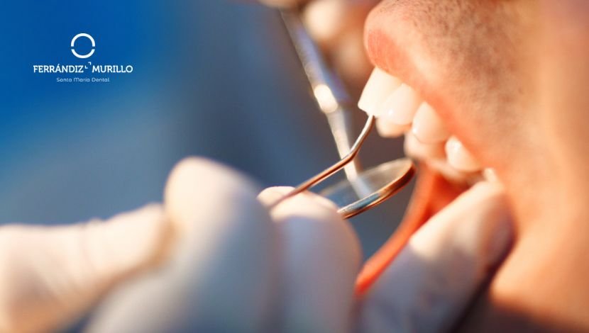 un periodontograma mide el estado de tus encías