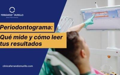 Qué es un periodontograma y cómo leer los resultados