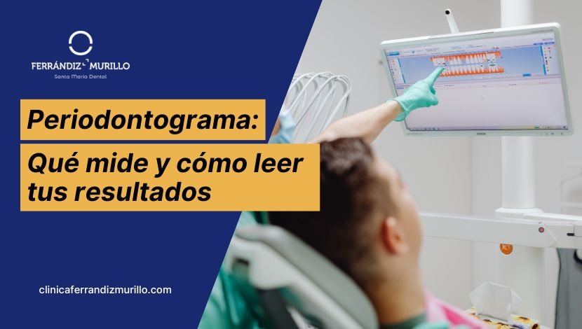 Periodontograma que es y para que sirve